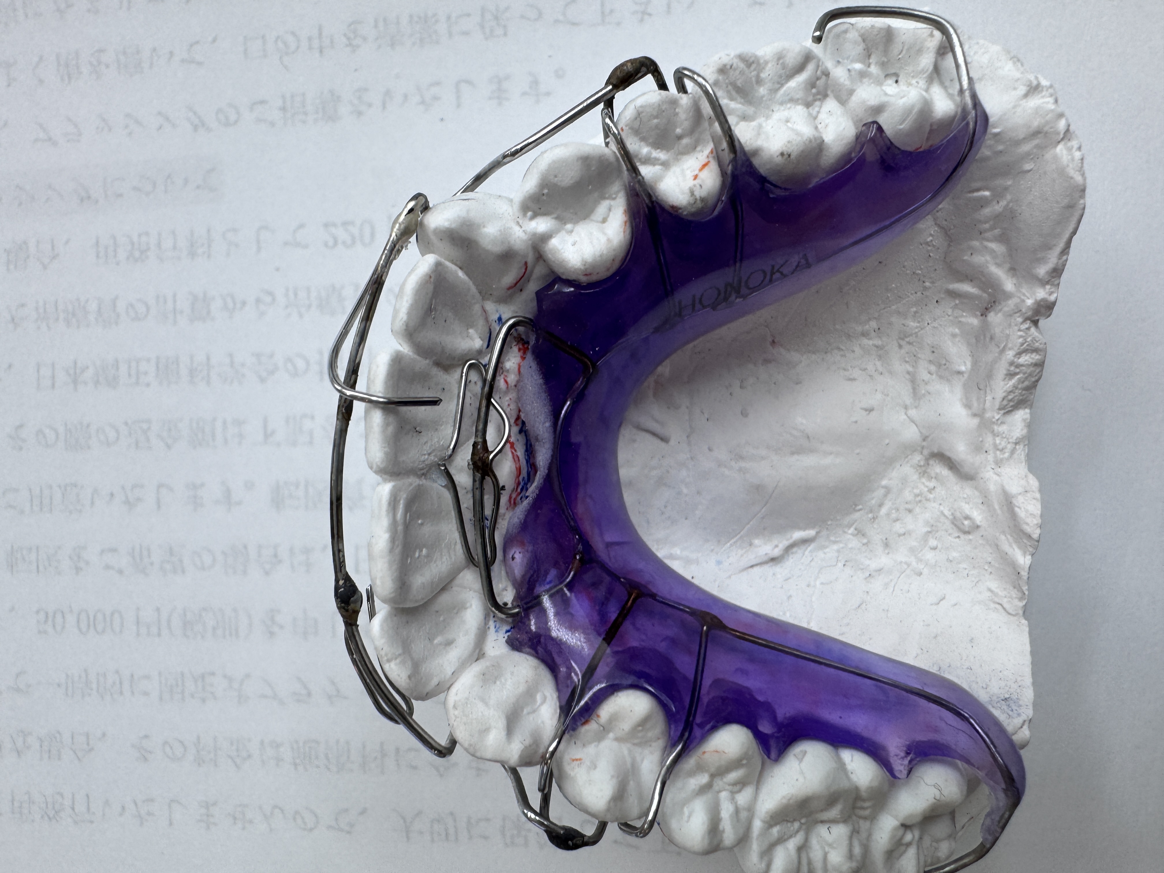 取り外しの出来る装置