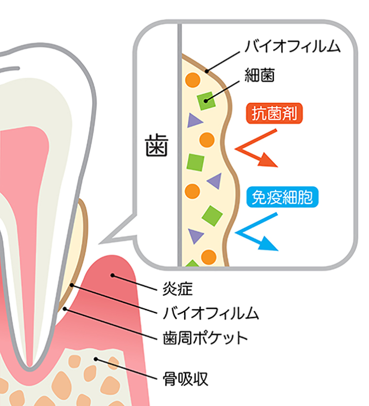 PMTCの目的