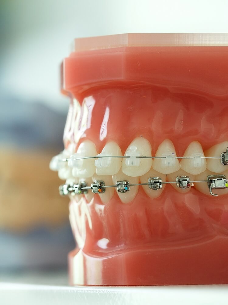 永久歯列期
